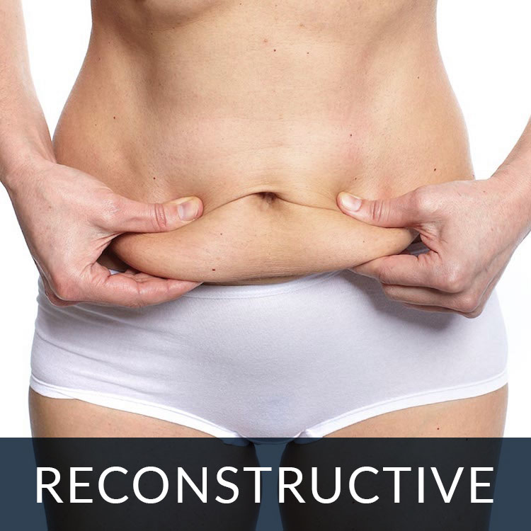 cosmetic surgery reconstruction
