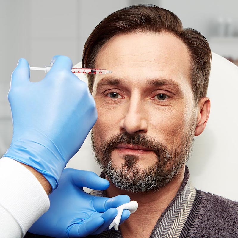 dermal fillers for men