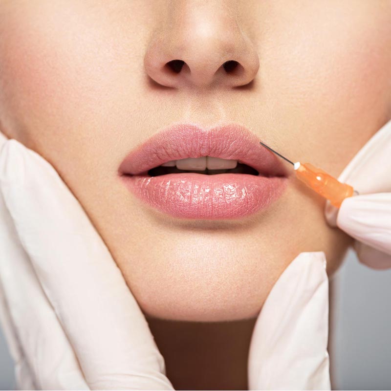 dermal fillers injectables atlanta