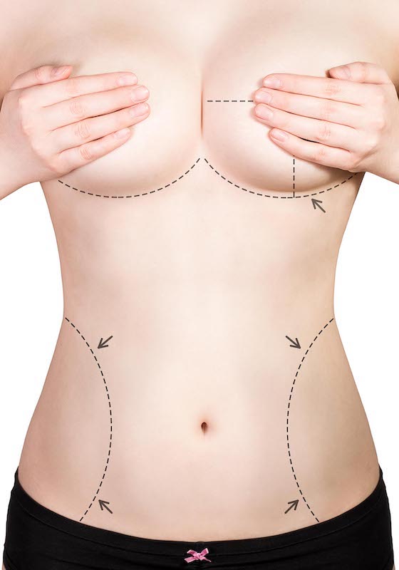 Breast Augmentation, John's Creek, GA