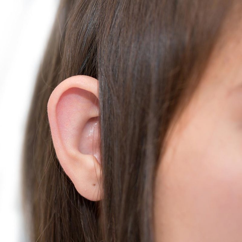 otoplasty ear pinning surgery atlanta