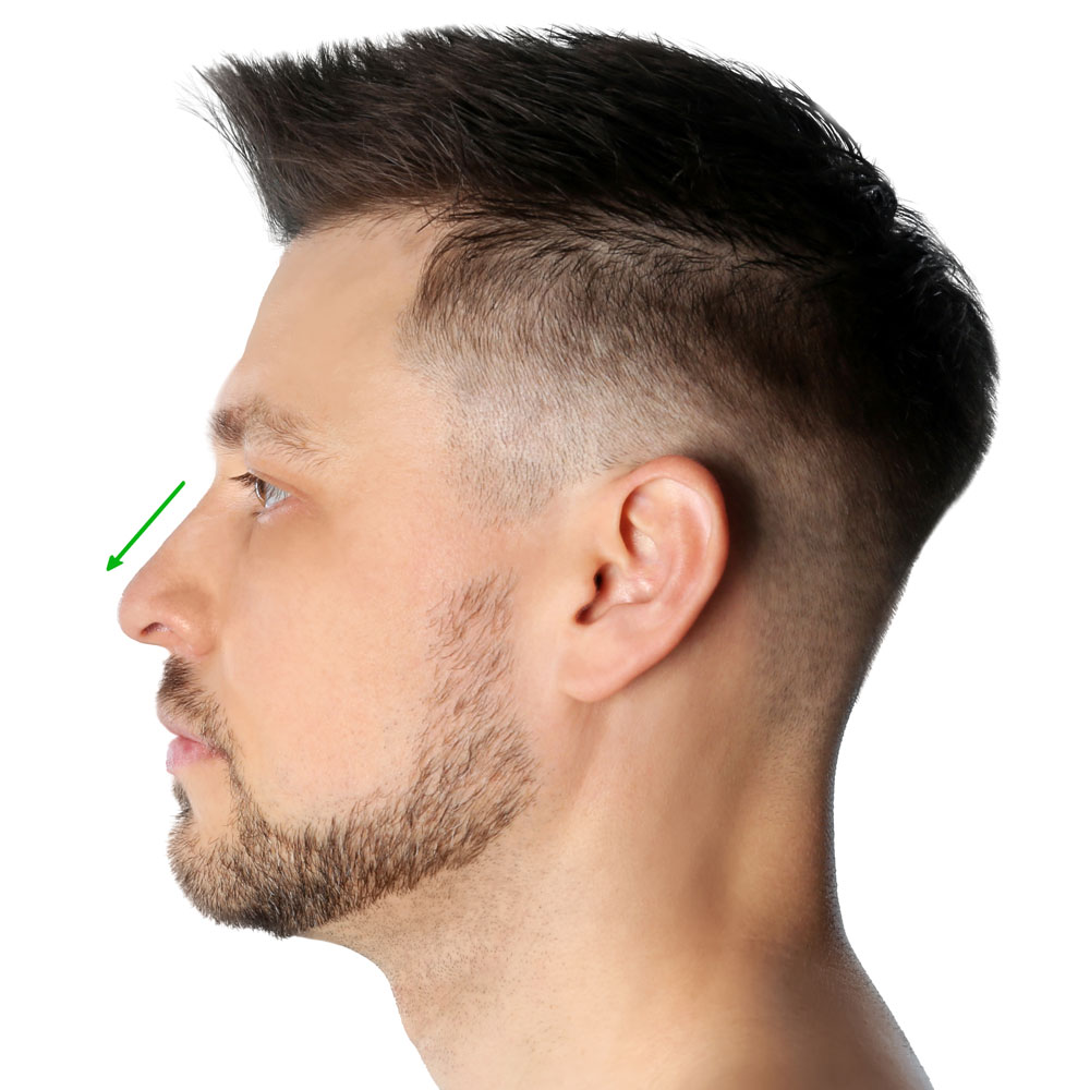 nose job for men atlanta