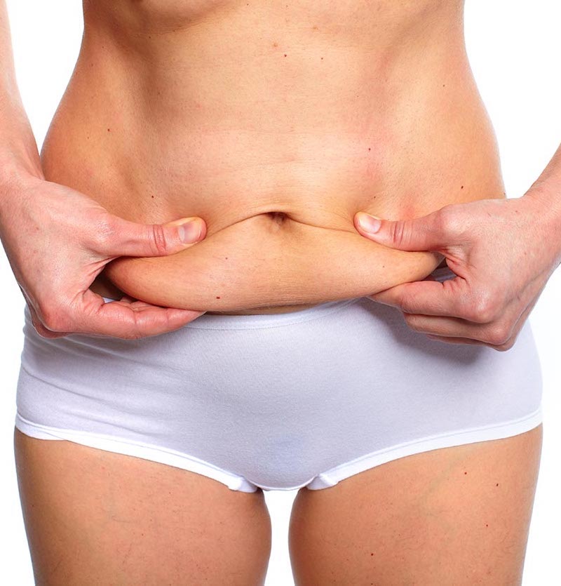 How Much Does A Mini Tummy Tuck Cost?