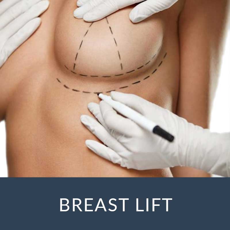 breast lift atlanta
