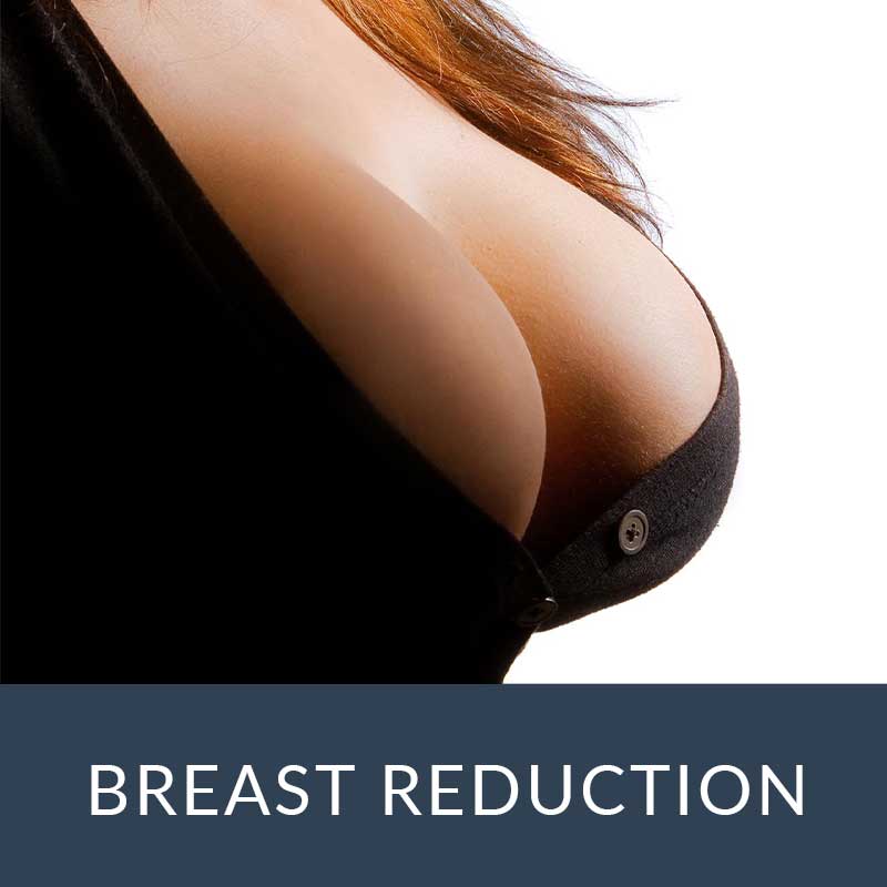 breast reduction atlanta